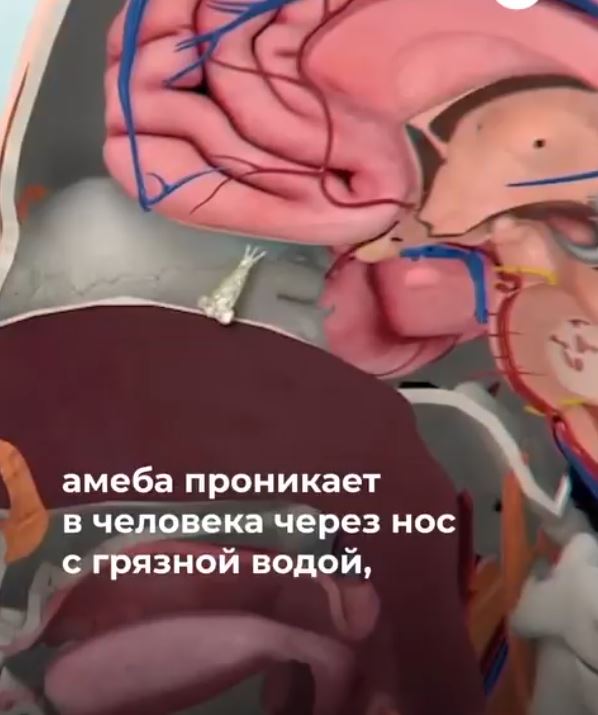 Неглерия Фоулера пожирающая Человеческий Мозг