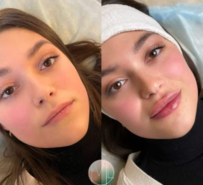 сколько держится результат